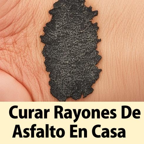 curar rayones de asfalto en casa